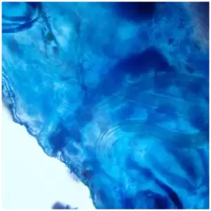 Azul Metileno